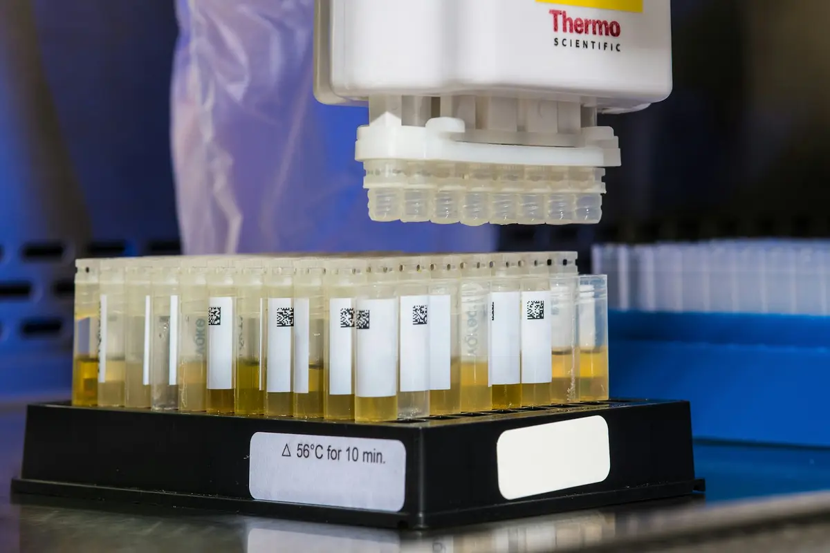 Patient samples in a lab rack under an automated pipette